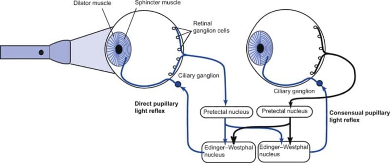 Diagram of the pupillary light reflex pathway, showing the afferent limb via CN II to the pretectal nucleus and the efferent limb via CN III to the iris sphincter.